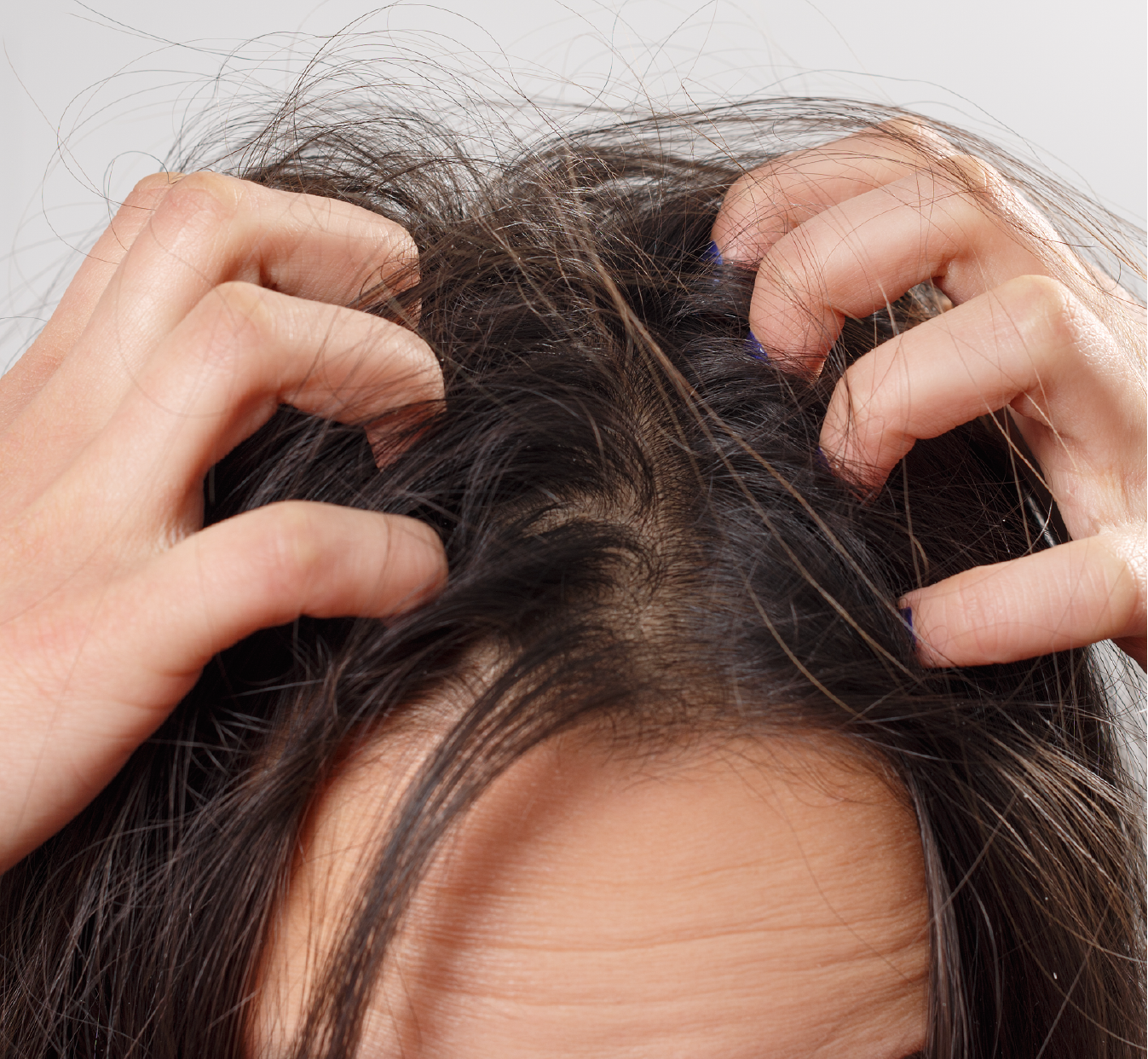 Woman scratching itchy head